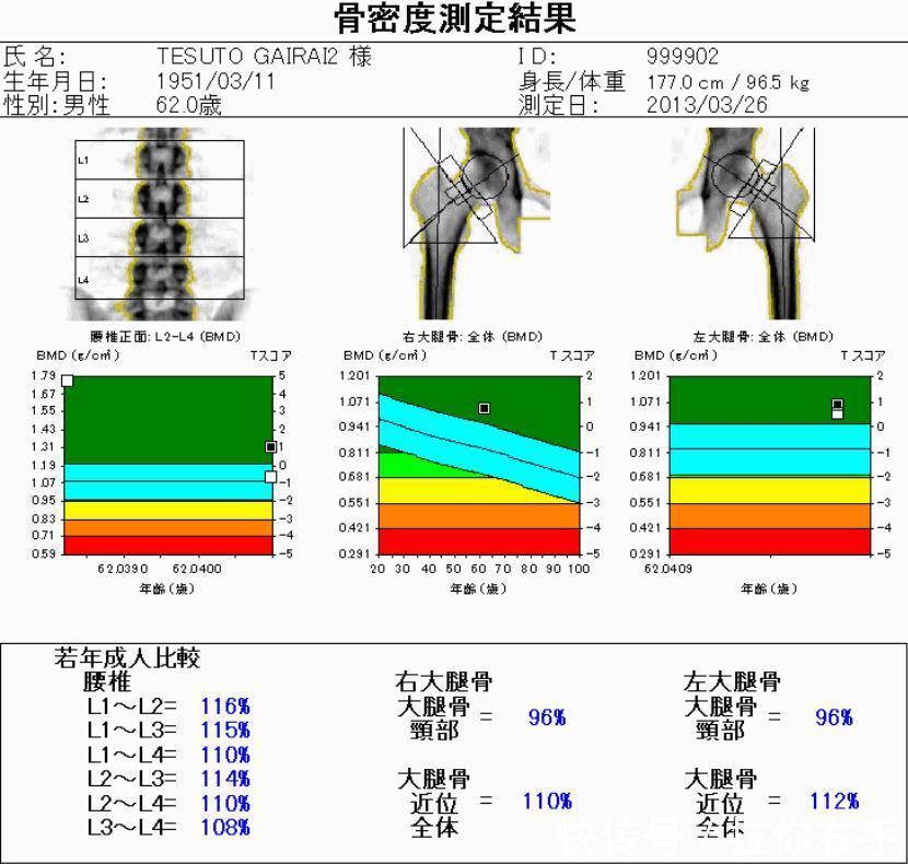 医生提醒骨质疏松不害怕,做到3点,骨骼健康又
