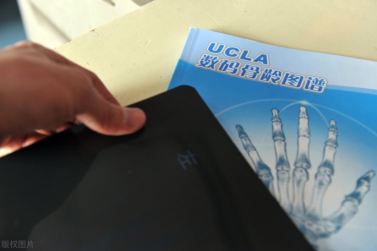 长高|想知道自家孩子未来身高,能不能科学预测?