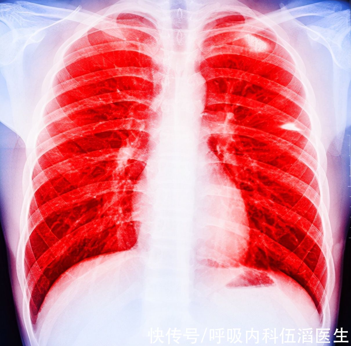 新药|肺癌来临，睡觉先知！医生有话说：肺部有癌的人，睡觉有这些表现