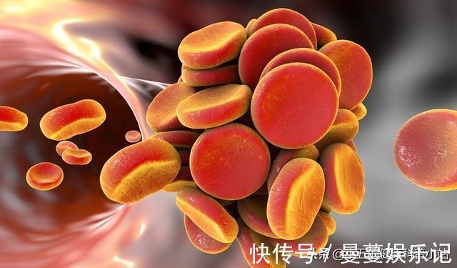 降脂|既能抗凝又能降脂稳定斑块?聊一聊常用的中成药——通心络胶囊