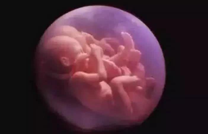 黄蒂|爸爸姓黄,给双胞胎女儿取名,开学老师点名,全班人都站了起来