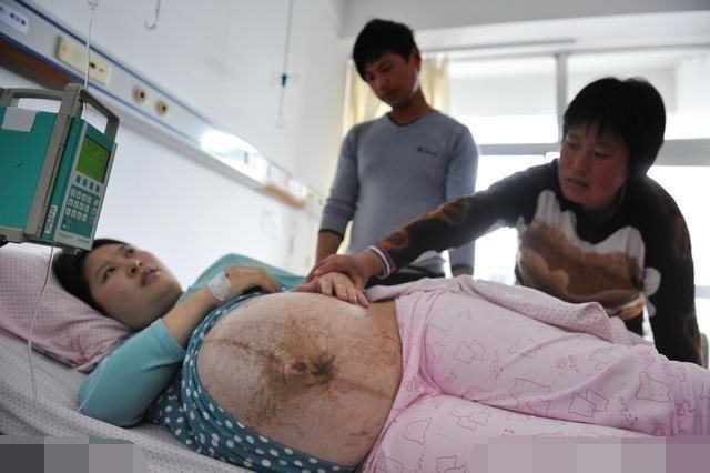 不良习惯|妻子怀孕3个月走不了路，去医院检查，医生却说有福气