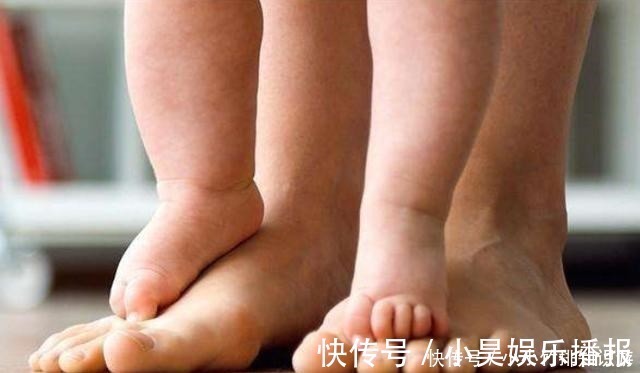 个子|孩子腿部出现2个“特点”,长大多半是高个子,你家孩子有没有