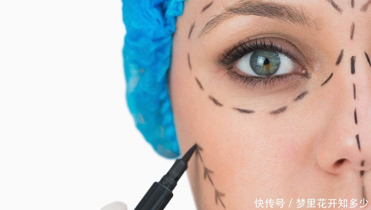 女子整鼻失败，调整三次都失败，工作人员：失败是成功之母