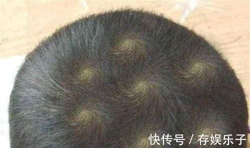 小伟|孩子头顶几个旋暗示着什么?别乱猜,科学的解释爸妈要牢记