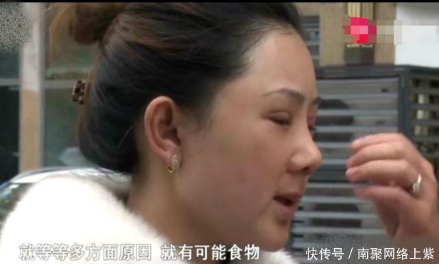 女子花9万元整容, 却脸肿脸烫的受不了, 如今完全像50岁大妈