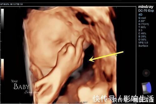 胎动|胎儿性格隔着肚皮能看出来吗?孕期欢脱的胎儿,出生后也多调皮