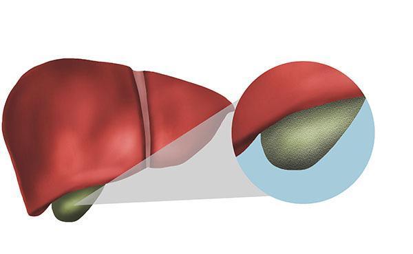 癌症|从确诊到离开仅三个月，凶险程度高的胆管癌就预防不了吗？