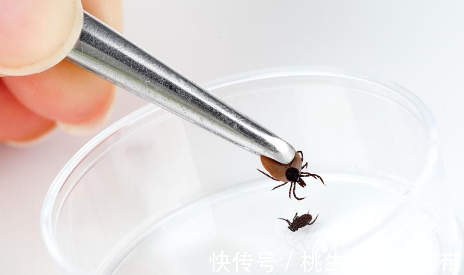 医生|夏天蜱虫多,孩子被咬后别硬拔,宝妈学会三个急救法,医生都夸好