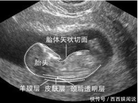 产检|怀孕40周做十多次产检都有必要吗?四项产检认真做,关乎胎儿健康