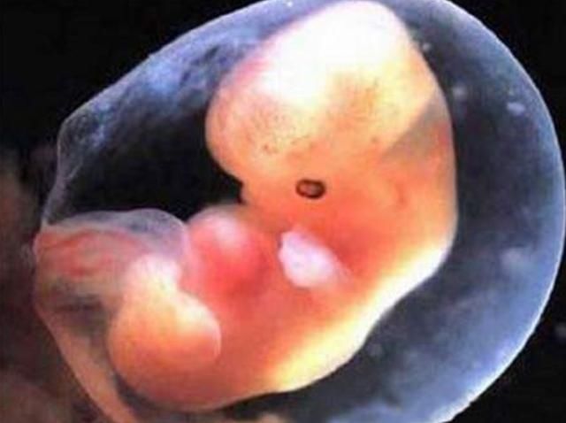 孕期综合症|孕期做到“4不碰”,有利于保持羊水“清澈”,胎儿住着更干净