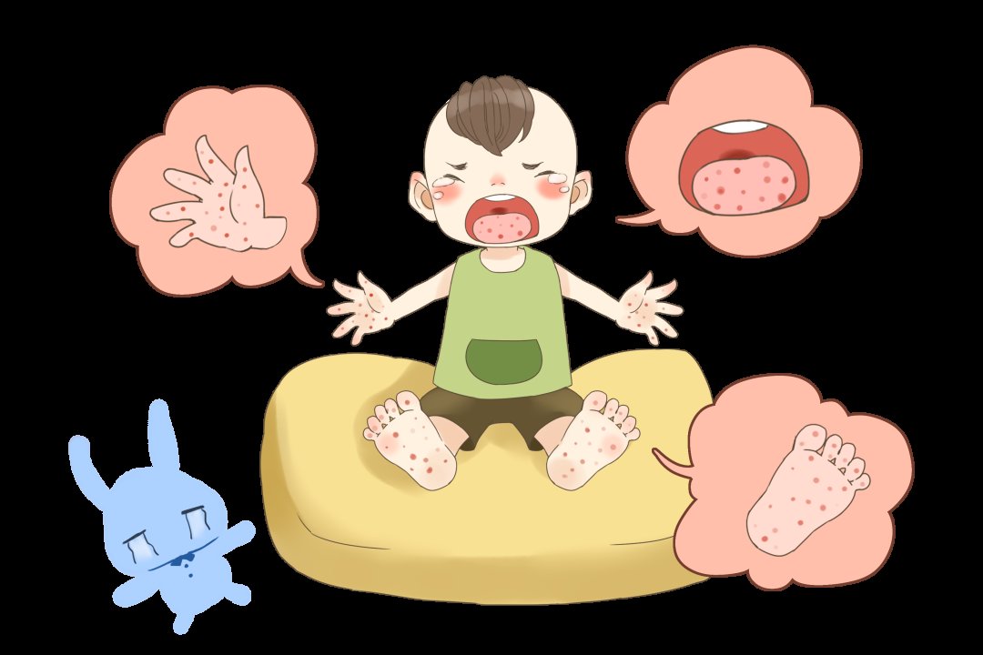 肠道病毒|手足口病、疱疹性咽峡炎夏秋季高发，家长需注意！