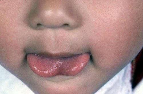 一个月|奶奶给满月孙子剃光眉毛,一个月后悔不当初,宝妈:您回老家吧