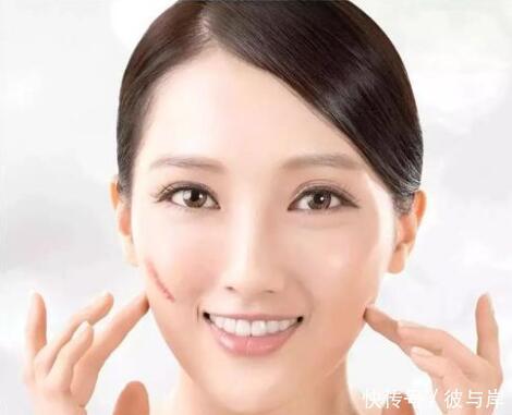 生育酚乙酸酯|4个去痘印方法,让痘印消失的更快!没用过的来