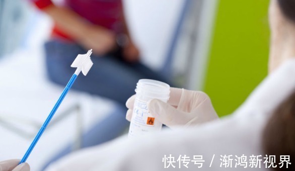 大夫|癌症会提前告知你4个征兆,大夫提醒此3个部位最好每年检查1次