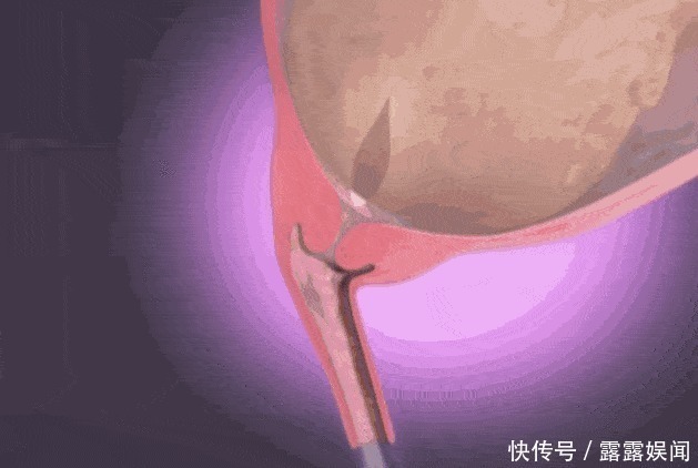 子宫|顺产到底有多疼,给你们看完这18图片,就能真正理解女人不容易