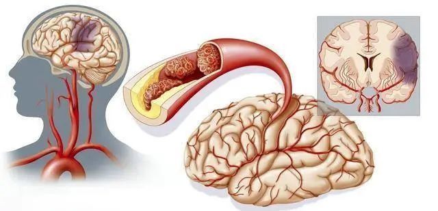 抗生素|【生活提醒】豆浆营养丰富，但这4类人不适合喝！