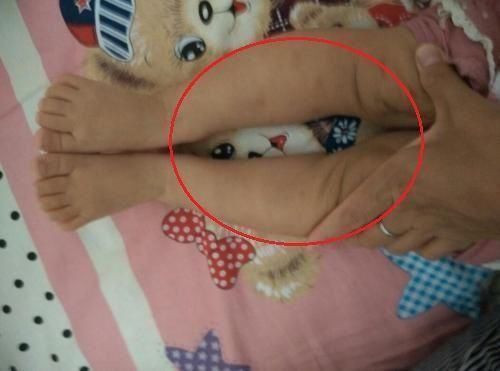 抱姿|中国孩子的腿,为啥没外国孩子的直,父母这改不了的习惯是关键
