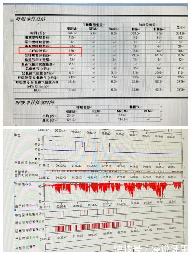 小林|男子一晚呼吸暂停176次?睡觉打鼾并非好事,背后或与这3件事有关