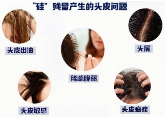 油头首选控油洗发水,拯救“油头星人”,放肆凹造型