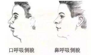 牙齿|牙齿三个 “关键期” ,千万别错过!否则毁掉孩子一口好牙