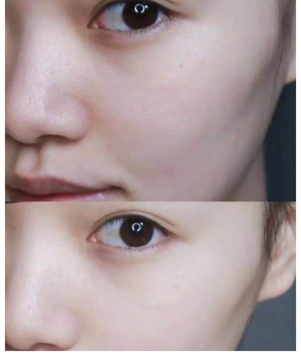 水润 早晨和晚上“护肤”的差距有多大?了解后才明白,差距会如此明显