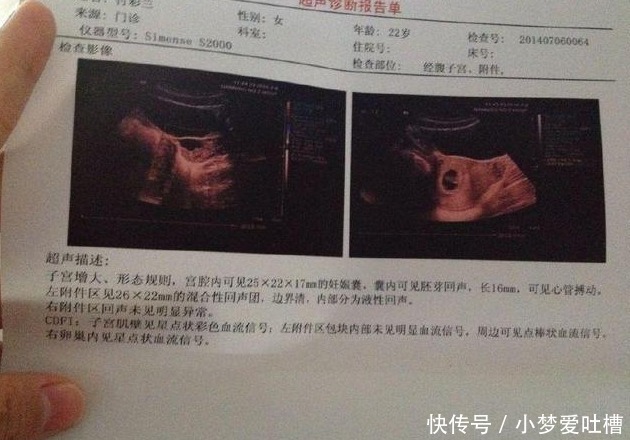 四维彩超|孕检过了这三关以后，孕妈就别担心，宝宝会健健康康