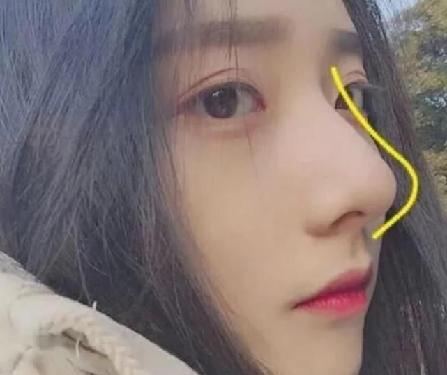 双眼皮|你是否拥有“幼稚脸”脸上若有这3个特征,有第3种减龄至少5岁