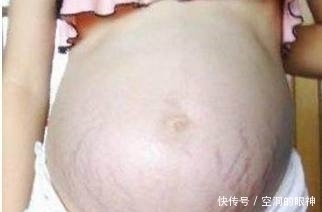 分娩|农村产妇进产房后塞给医生一张纸条,医生看到后竟哭成泪人