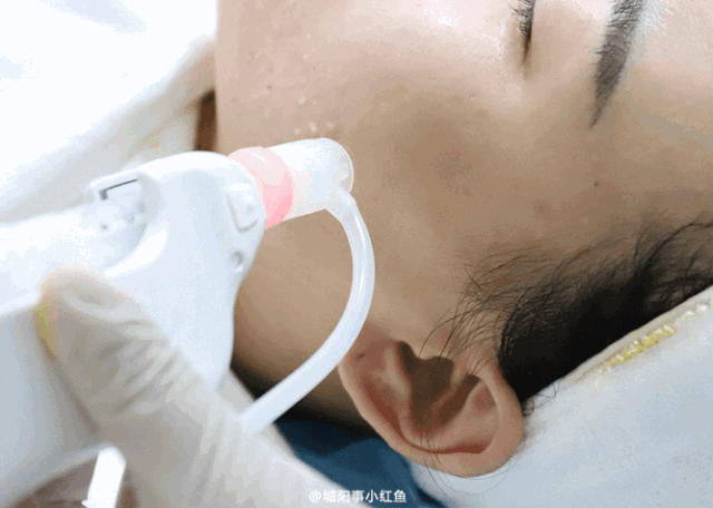 春季适合哪些整容项目？丨科普篇