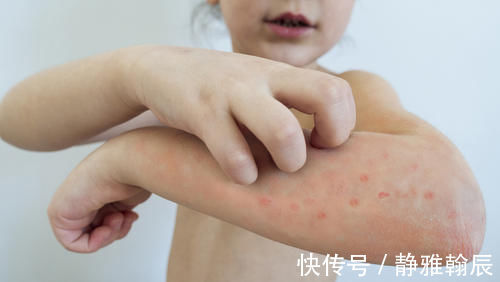 石榴皮|老中医献方：石榴皮别扔掉，磨成粉末涂一涂，轻松搞定各种皮肤病