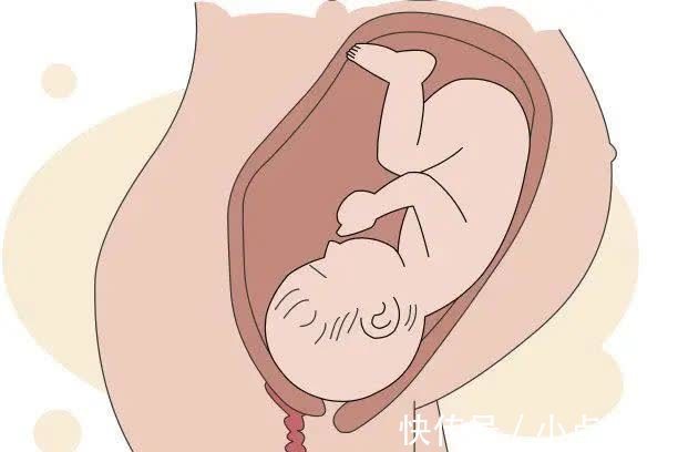 假性|孕妇散步导致早产,若是这三种情况,还是多休息比较好