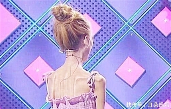 现在就告白|当年从120减到58斤,为爱变成“骷髅妹”的刘野,如今过得怎样?