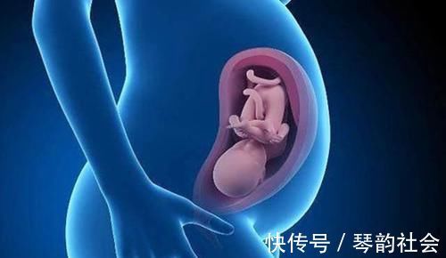 谢依霖|水中分娩好处颇多,为啥女明星很少用呢?产科专家:钱再多也没招