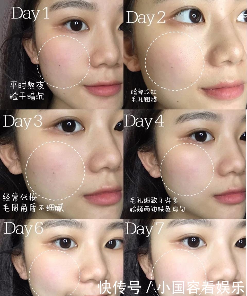 护肤|做到这3点,和痘痘肌说再见,让你素颜也很美