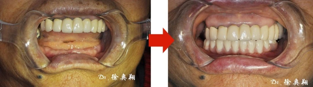 热线|相互转告！最后8天！没有领取这项福利补贴的赶快报名，不限户籍