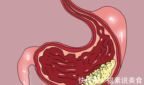 复发率|哪些癌症的术后复发率高医生全部列出来了,尽量记住吧
