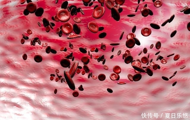  依次|得了高血脂不用慌，这些事情依次做好，血脂不敢“作乱”