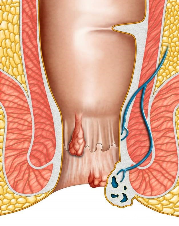 医生|女子头晕半年，以为患癌症，检查结果让她觉得重获新生
