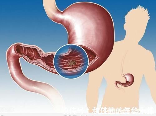 水果|胃不好,要注意什么?提醒:想要养胃,需要避开4种水果,为你好