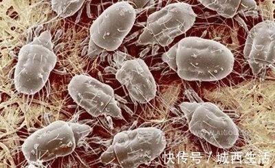 枕头上有这些痕迹,说明被螨虫寄生,教你一招床上无螨虫