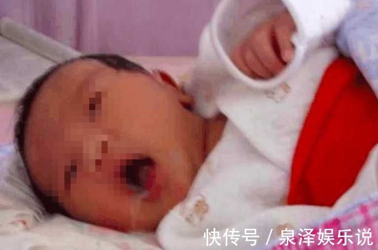 肾衰竭|一岁宝宝肾衰竭意外死亡,原因是妈妈喂的白粥,各位家长要注意