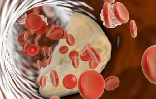 异常|血管堵不堵，头部先知道，若头部没有3种异常，说明血管很通畅