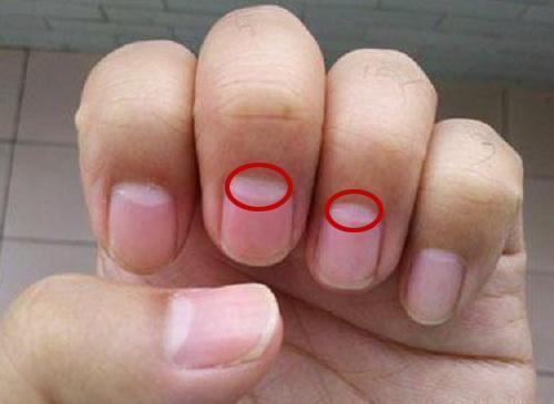 妇科疾病|没有妇科疾病的女人,手上有4个特征,你若占1个,子宫很健康