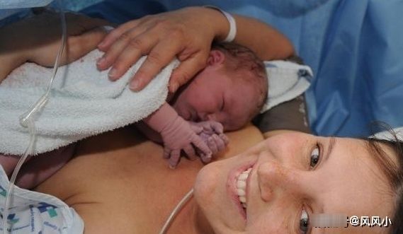 时间点|剖腹产时,若你赶上这个时间点,或许对产妇和宝宝都好!