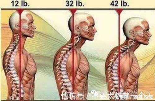 椎动脉|颈椎安康:得了颈椎病不要怕,四个防护方法助您保护您的颈椎