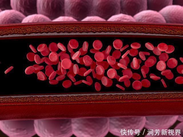 血管堵没堵,一“摸”就知道,5个方法让血管干干净净