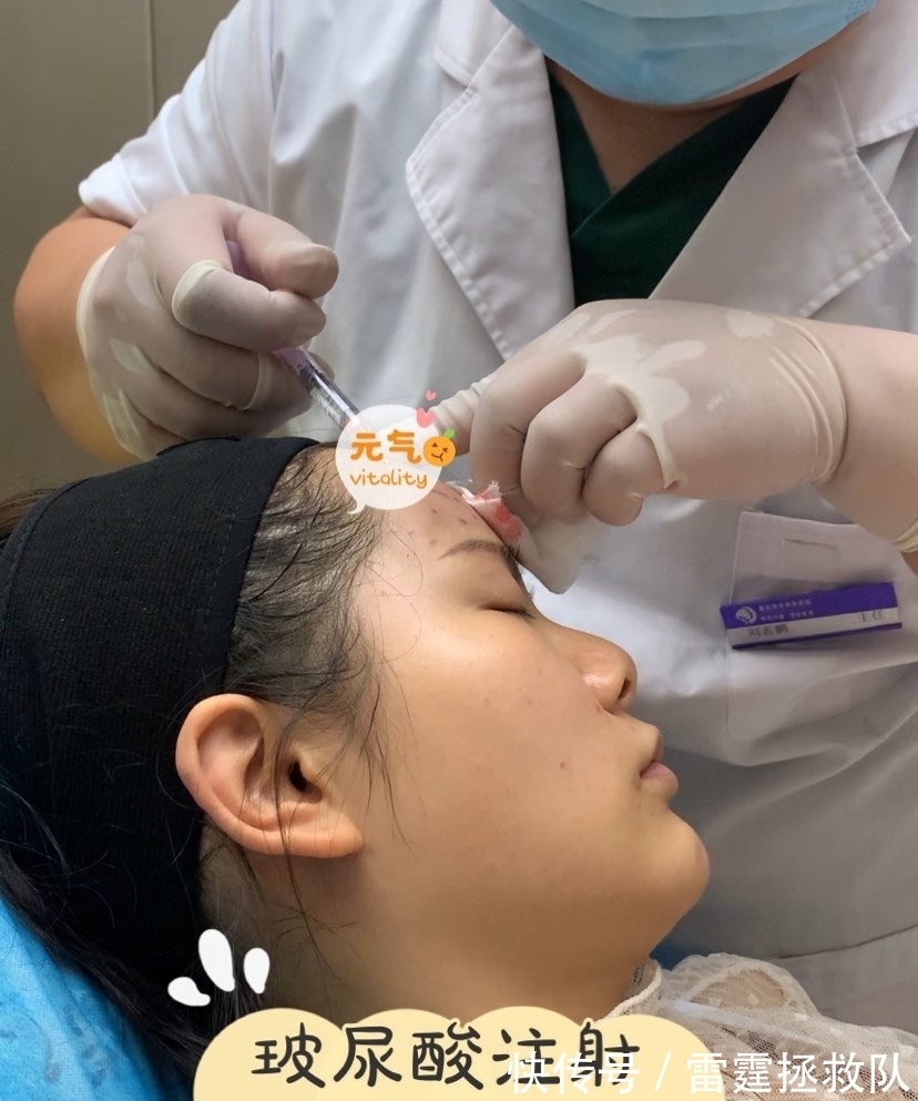 颧骨|太阳穴凹陷、颧骨突出?可能是这个部位造成的!