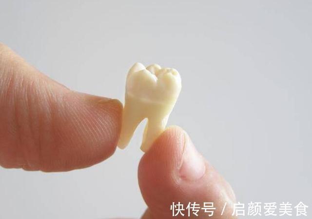 恒牙|儿童换牙顺序图:孩子几岁换?怎么换?一文说清