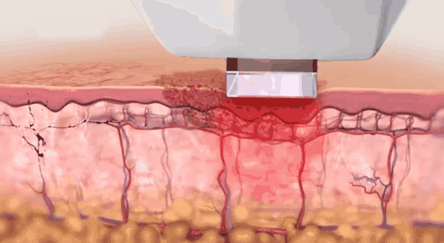 济南海峡整形分享:开学前变美攻略请收好